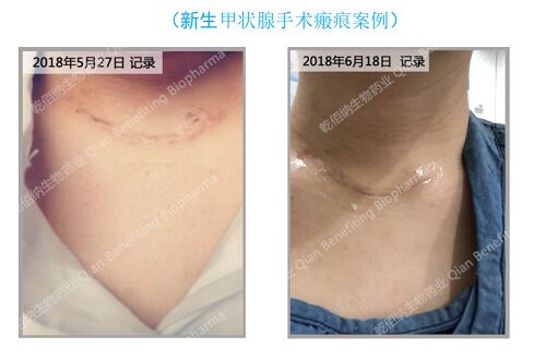 888(1)_看图王.jpg
